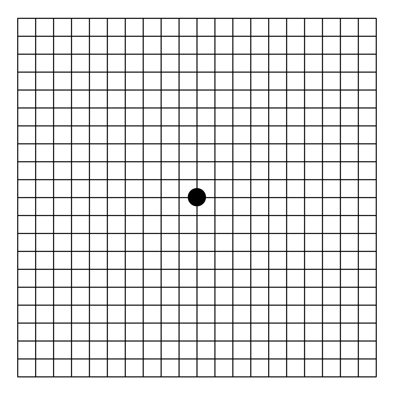 The Amsler grid, a self-test for early signs of macular degeneration
