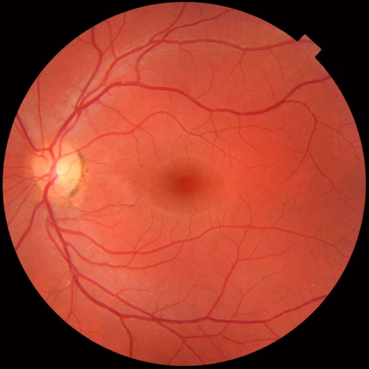 Color fundus photograph of a healthy left retina, showing optic nerve, macula, and vasculature